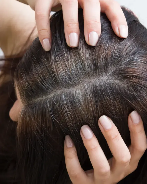 Tricologia com base em mecanismo: trate a causa, não o efeito.